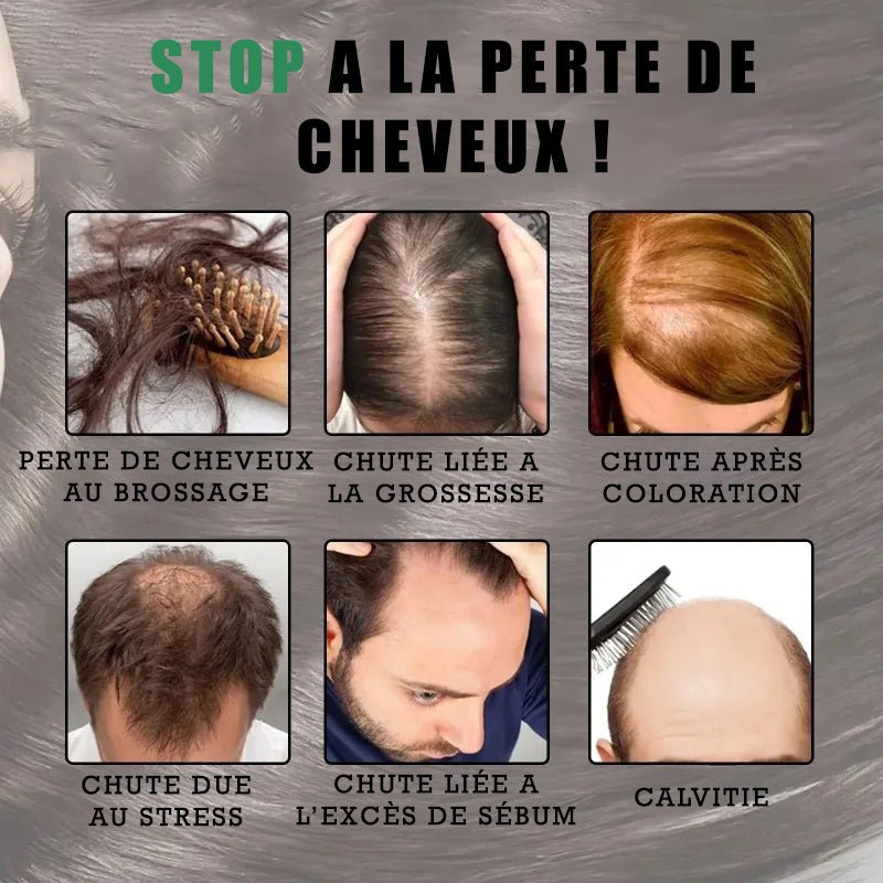 Élixir Concentré de Romarin pour Cheveux-4